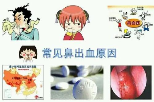 止住鼻血的3大方法
