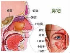 鼻窦炎反反复复?别怕!这样可以低复发……