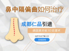 成都鼻中隔偏曲需要进行手术的指针?