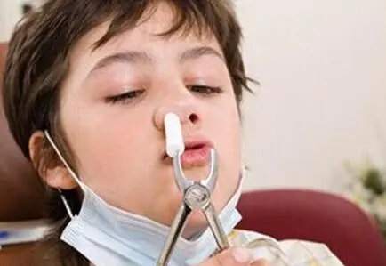 怎样区分鼻炎和鼻窦炎?